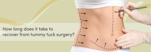 How long does it take to recover from tummy tuck surgery?